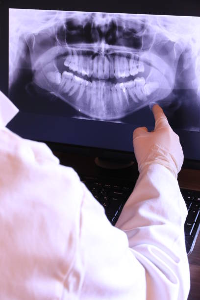 Best Emergency Dental Extractions in Hudson Bend, TX