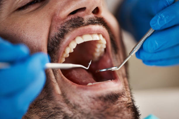 Best Pediatric Emergency Dentist in Hudson Bend, TX